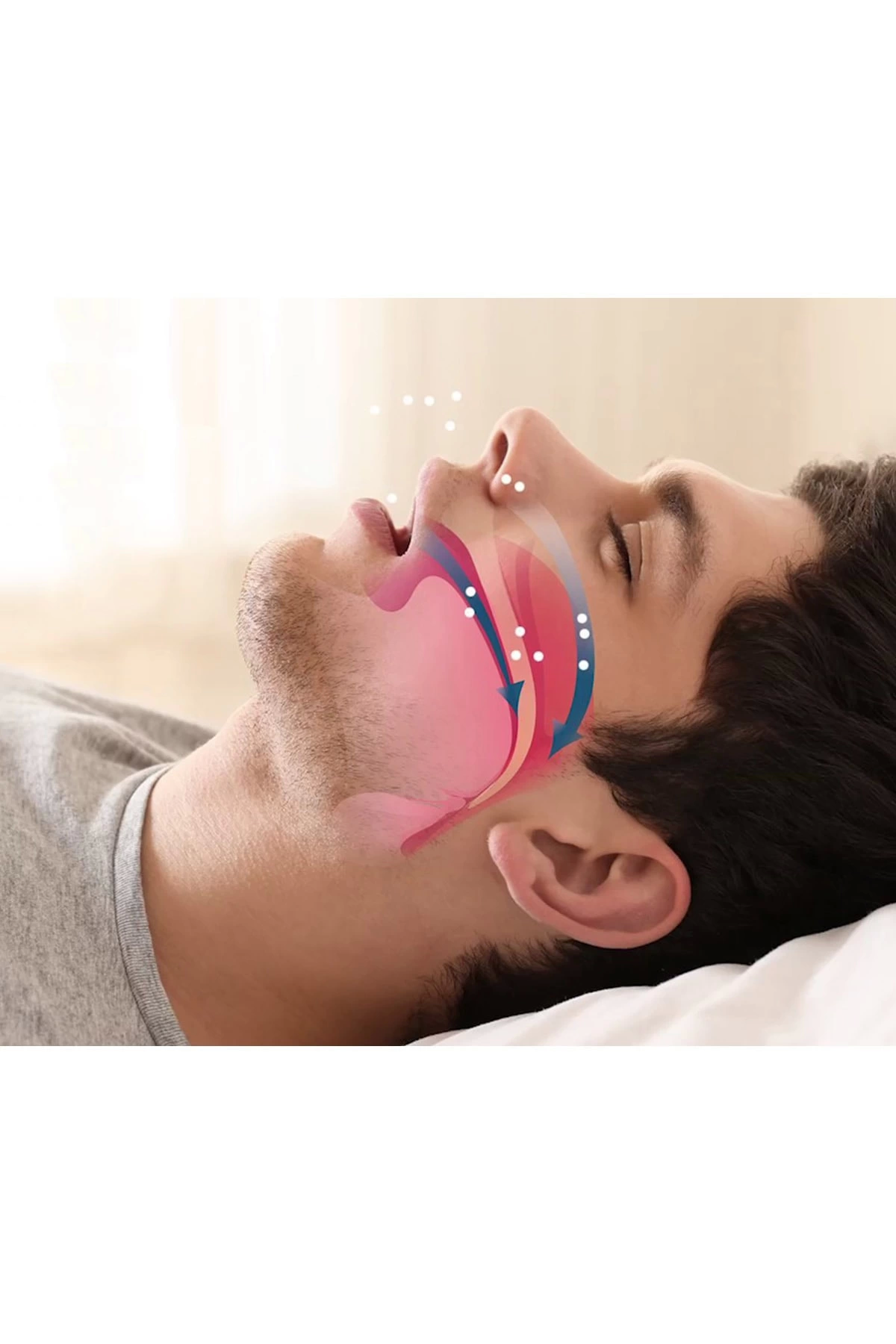 Rahat Uyku İçin Anti Snore Sleep Horlama Engelleyici Aparat Uyku Stoperi ( Lisinya ) - Görsel 3